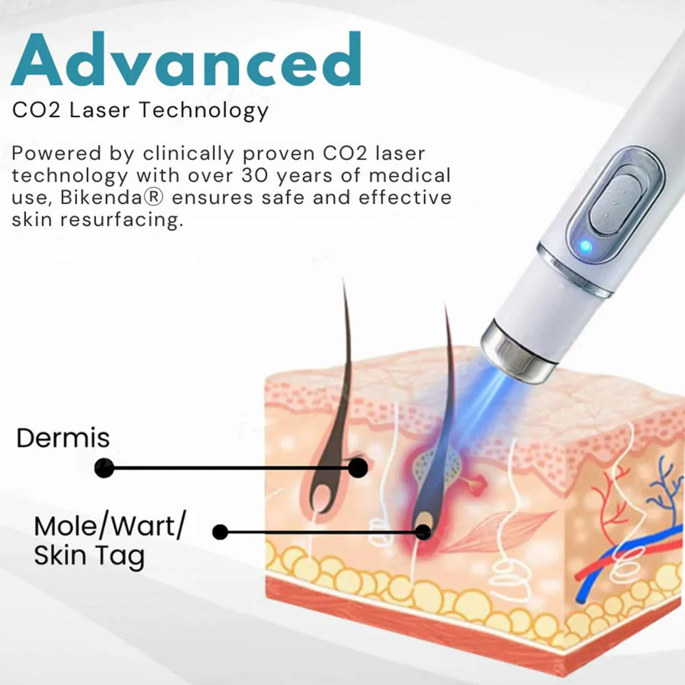 Non-Invasive Mole and Wart Removal Pen