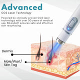 Non-Invasive Mole and Wart Removal Pen