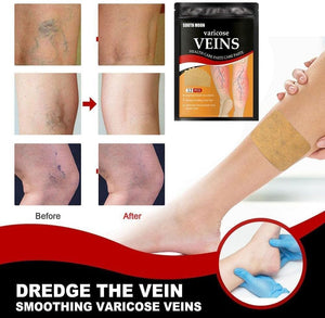 Varicose Veins Patch 🩹