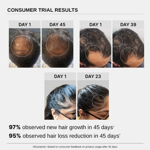 Bare Anatomy Hair Growth & Hair Fall Control Serum (30ml)