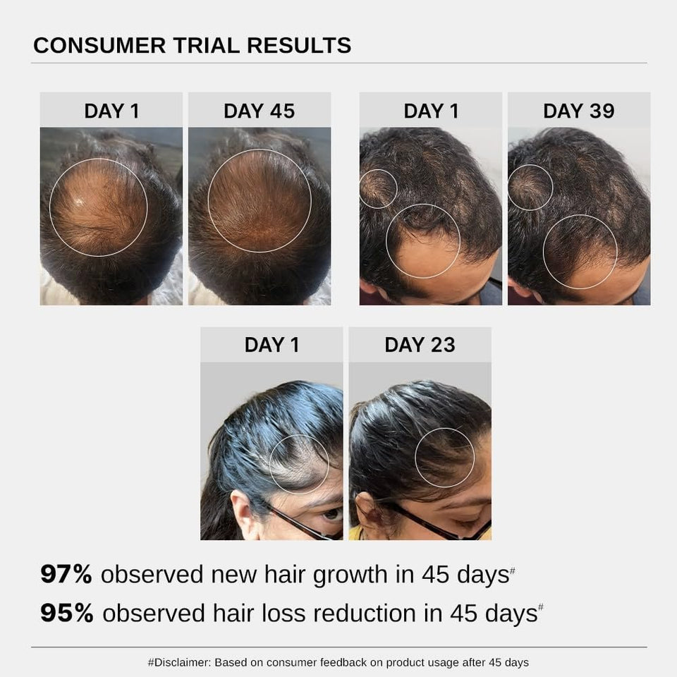 Bare Anatomy Hair Growth & Hair Fall Control Serum (30ml)