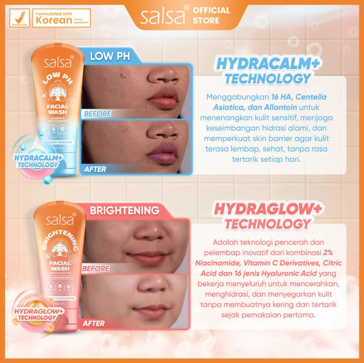 Salsa Acne Intensive Care Spot Cream (15g) – Pimple Treatment / Acne Spot Cream