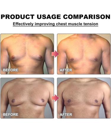 Men Therm Bee Venom Gynecomastia Heating Oil