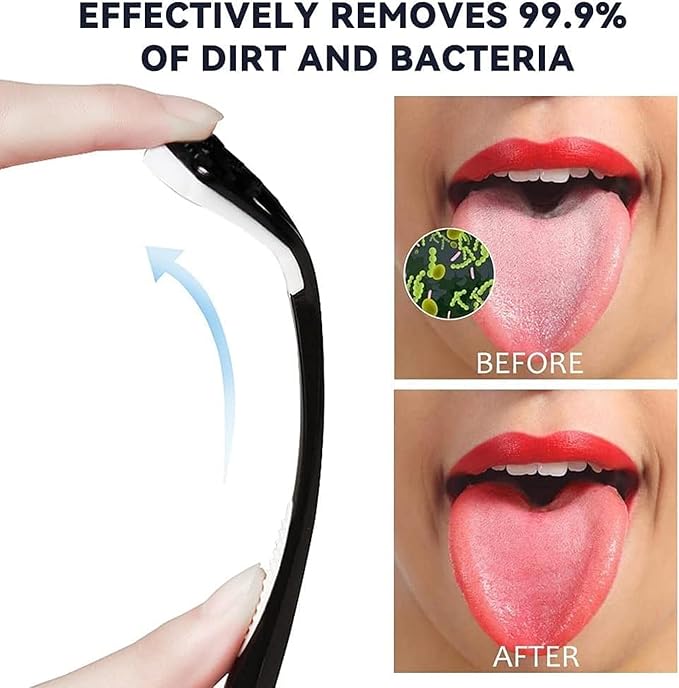 Colorful Silicone Tongue Scraper Cleaner
