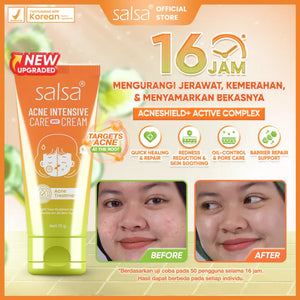 Salsa Acne Intensive Care Spot Cream (15g) – Pimple Treatment / Acne Spot Cream