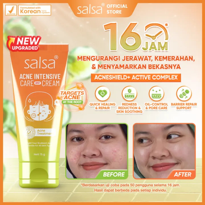 Salsa Acne Intensive Care Spot Cream (15g) – Pimple Treatment / Acne Spot Cream