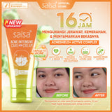 Salsa Acne Intensive Care Spot Cream (15g) – Pimple Treatment / Acne Spot Cream
