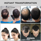 THICK FIBER Hair Fibers for Thinning Hair (Black) 25g Bottle, Hair Loss concealer for Men & Women