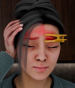 Migraine Pain Relief Clip-Pack of 2