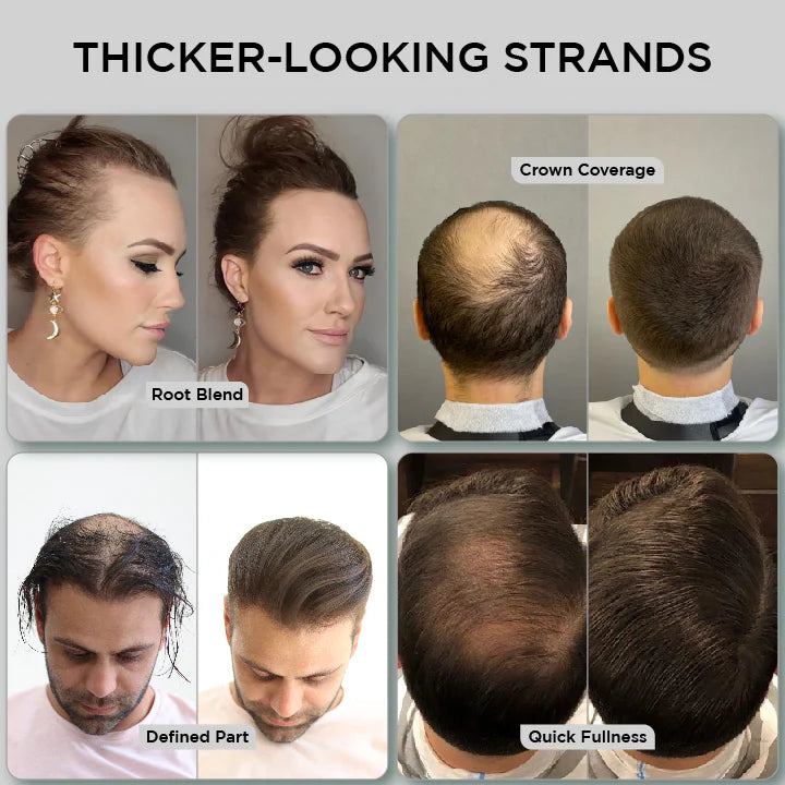THICK FIBER Hair Fibers for Thinning Hair (Black) 25g Bottle, Hair Loss concealer for Men & Women