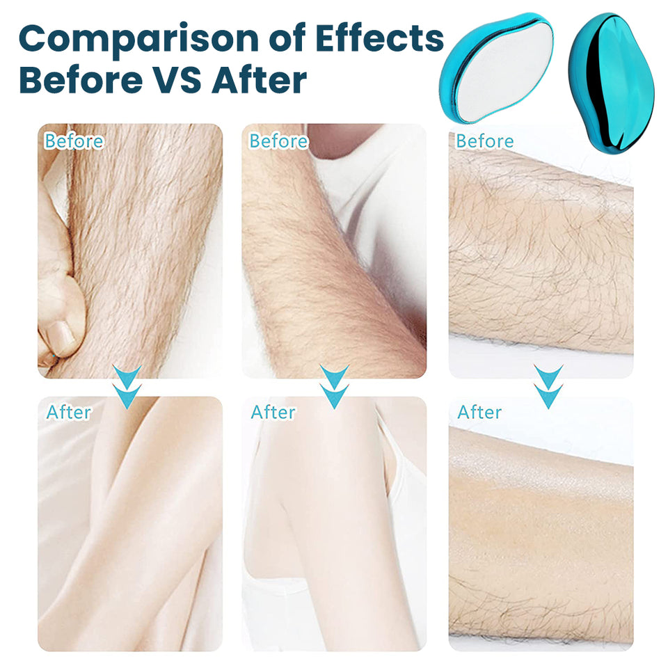 Eraser peeling and hair removal without pain
