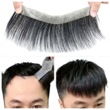 Men’s frontal stick-on hairline with natural human hair (Brand – Anemone)
