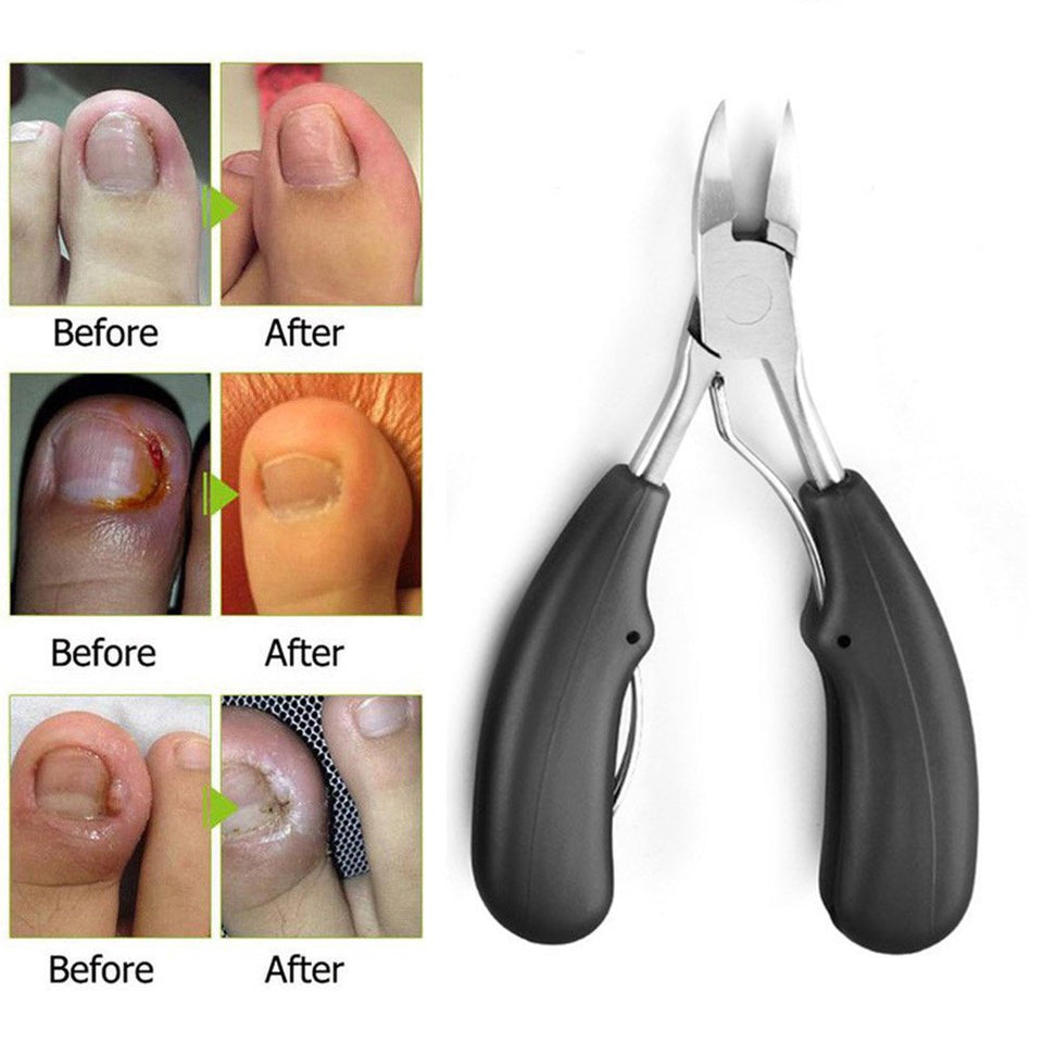 Ingrown Toe Nail Clipper
