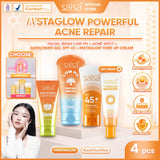 Salsa Acne Intensive Care Spot Cream (15g) – Pimple Treatment / Acne Spot Cream