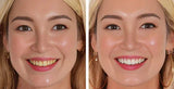Dazzling Teeth Whitening Pen