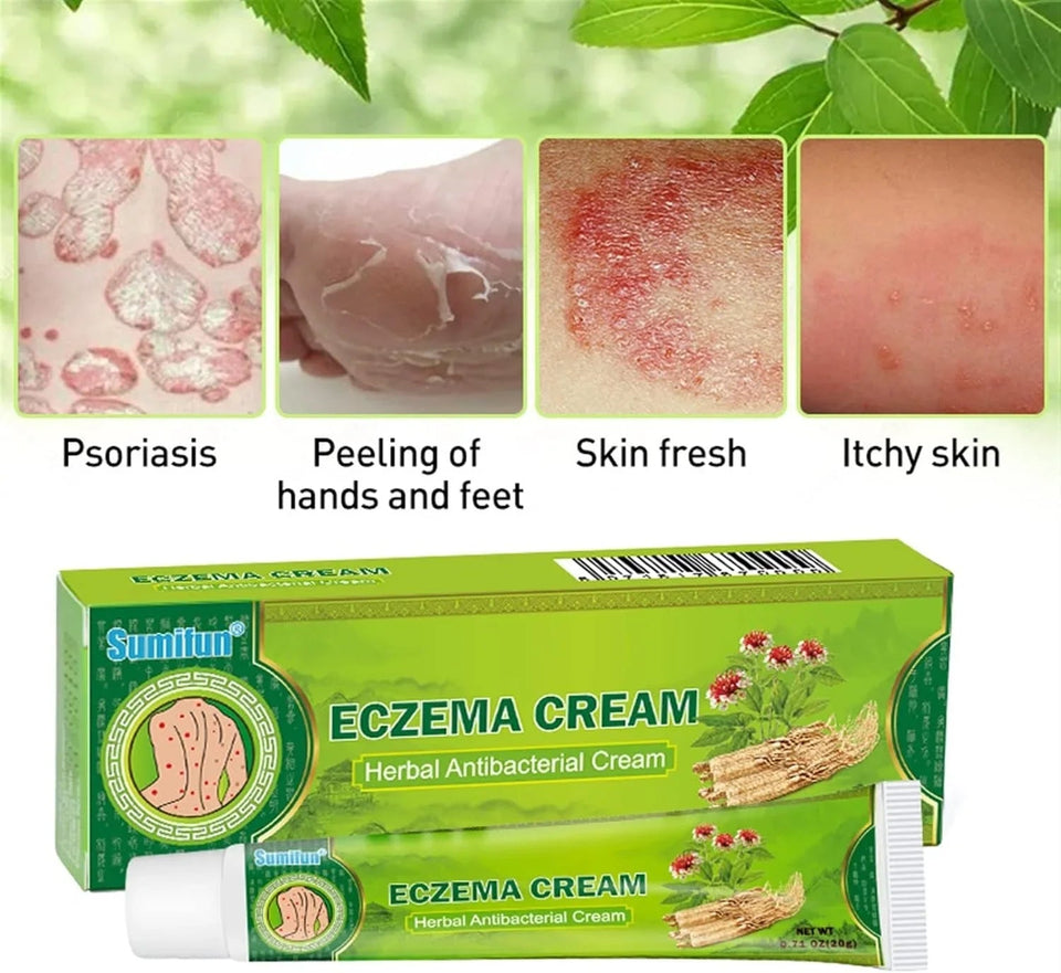 Sumifun Eczema Herbal Antibacterial Cream
