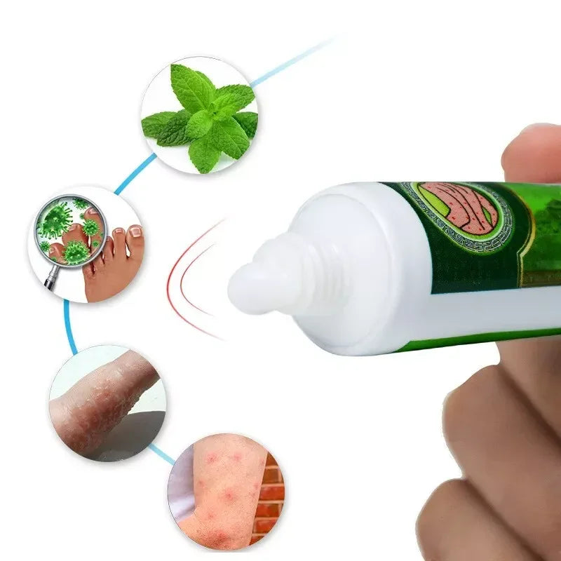 Sumifun Eczema Herbal Antibacterial Cream