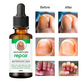 Nail Serum for Repair & Growth