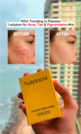 Turmeric & kojic acid brightening soap